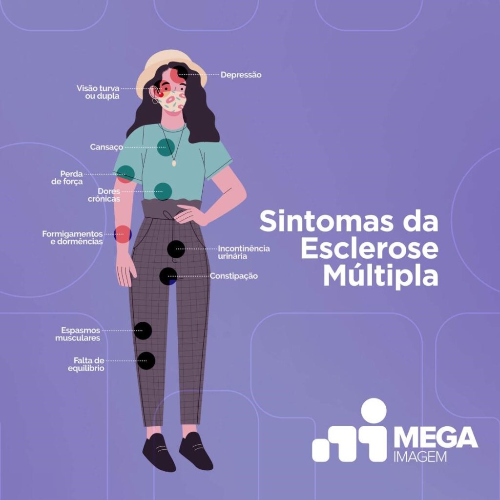 Ilustração de sintomas de Esclerose Múltipla
